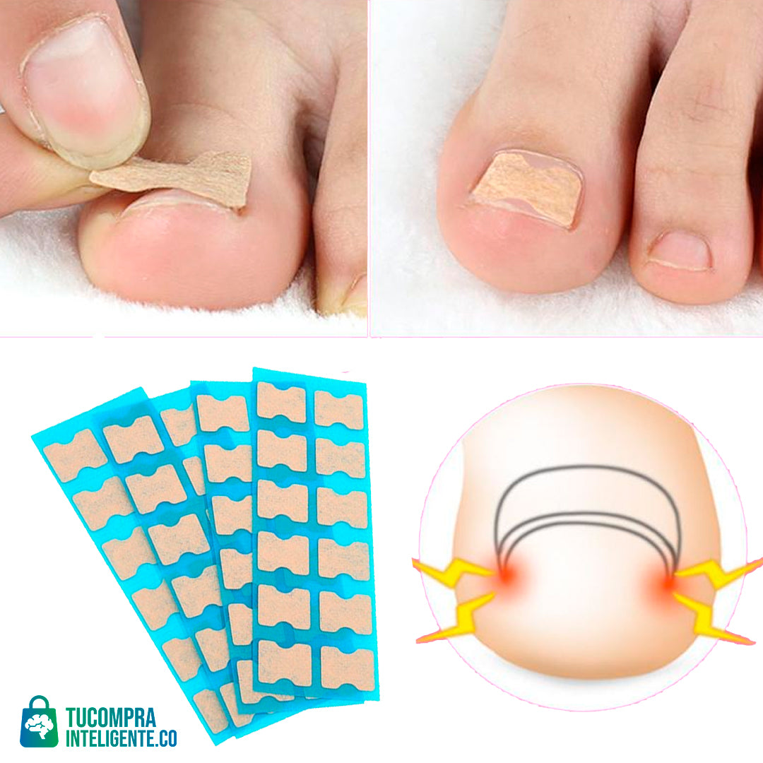 Sticker para Uñas Encarnadas / Adiós al dolor