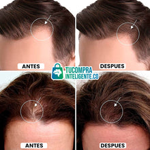 Cargar imagen en el visor de la galería, ELEVATE / Crecimiento del Cabello