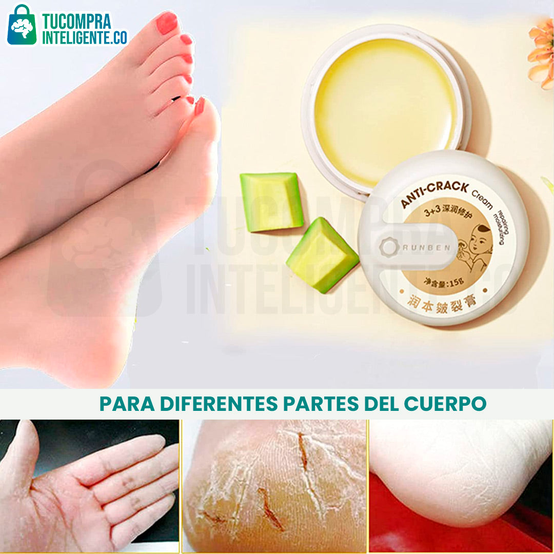 Anti Crack Cream / Hidrata y Repara la Piel